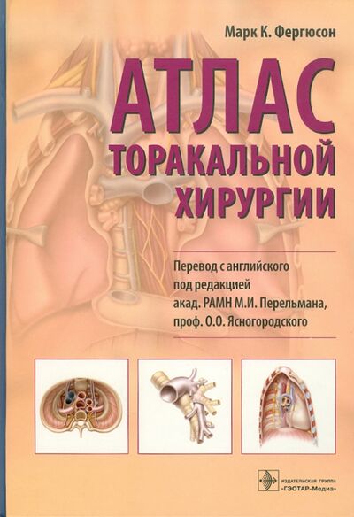 Книга: Атлас торакальной хирургии (Фергюсон Марк К.) ; ГЭОТАР-Медиа, 2009 