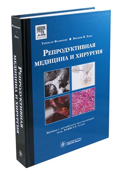 Книга: Репродуктивная медицина и хирургия (Фальконе Томмазо, Херд Вильям В.) ; ГЭОТАР-Медиа, 2014 