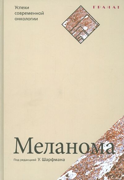 Книга: Меланома (Шарфман У. (ред.)) ; Гранат, 2015 
