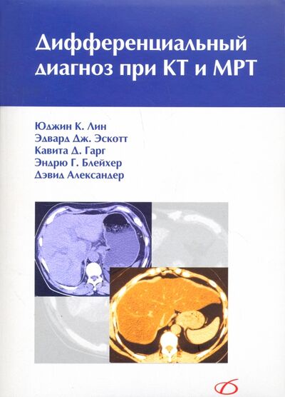 Книга: Дифференциальный диагноз при КТ и МРТ (Лин Юджин К., Эскотт Эдврд Дж., Кавита Гарг Д.) ; Медицинская литература, 2017 