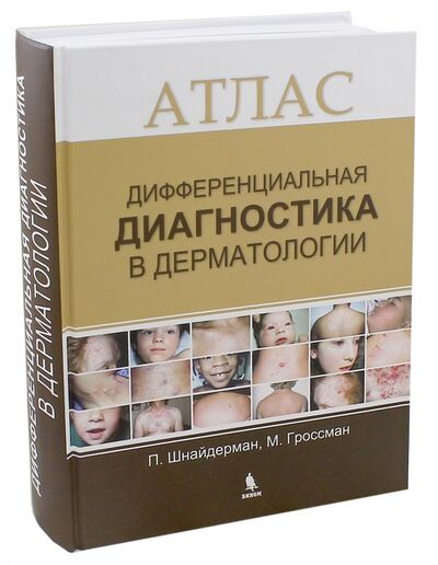 Книга: Дифференциальная диагностика в дерматологии. Атлас (Шнайдерман Пол, Гроссман Марк) ; Бином, 2017 