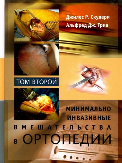 Книга: Минимально инвазивные вмешательства в ортопедии. Том 2 (Скудери Джилес Р., Триа Альфред Дж.) ; Издательство Панфилова, 2014 