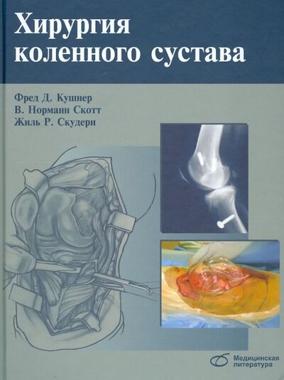 Книга: Хирургия коленного сустава (Кушнер Фред Д., Скотт Норман В., Скудери Джилес Р.) ; Медицинская литература, 2014 