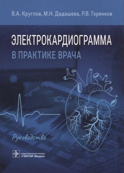 Книга: Электрокардиограмма в практике врача руководство (Горенков, Дадашева, Круглов) ; Гэотар-Медиа, 2022 