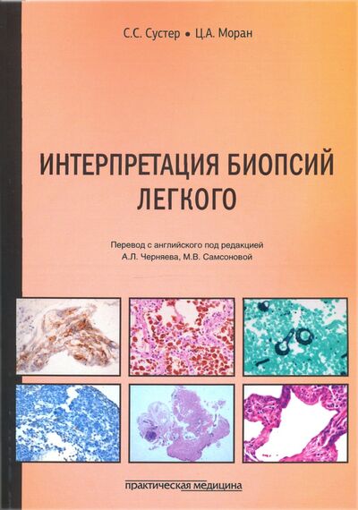 Книга: Интерпретация биопсий легкого (Сустер С. С., Моран Ц. А.) ; Практическая медицина, 2021 