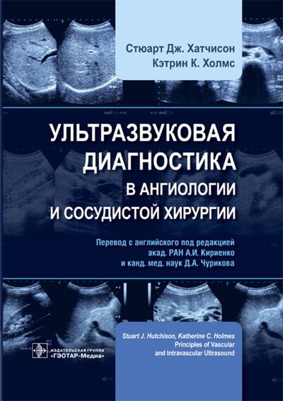 Книга: Ультразвуковая диагностика в ангиологии и сосудистой хирургии (Хатчисон Стюарт Дж., Холмс Кэтрин К.) ; ГЭОТАР-Медиа, 2023 