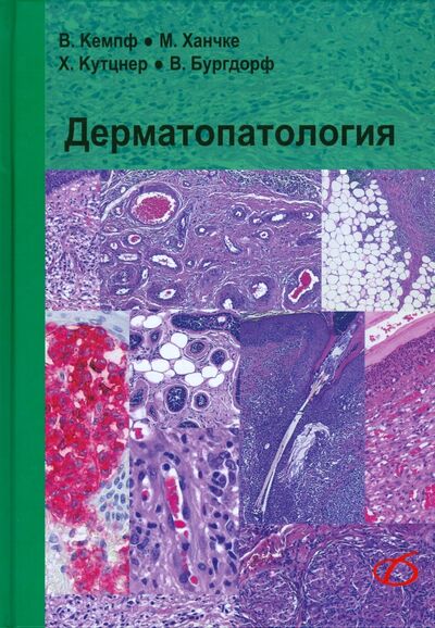 Книга: Дерматопатология (Кемпф Вернер, Ханчке Маркус, Кутцнер Хайнц) ; Медицинская литература, 2015 