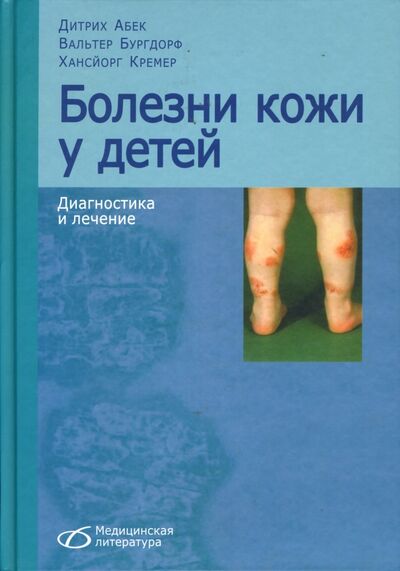 Книга: Болезни кожи у детей. Диагностика и лечение (Абек Дитрих, Бургдорф Вальтер, Кремер Хансйорг) ; Медицинская литература, 2007 