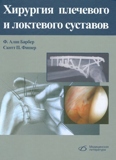Книга: Хирургия плечевого и локтевого суставов (Барбер Алан Ф., Фишер Скотт П.) ; Медицинская литература, 2014 