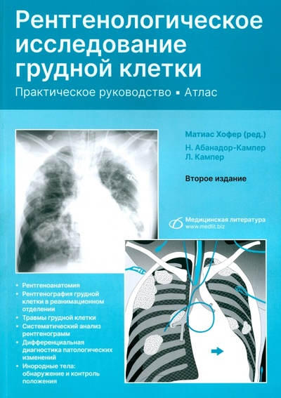 Книга: Рентгенологическое исследование грудной клетки. Практическое руководство. Атлас (Хофер Матиас) ; Медицинская литература, 2023 