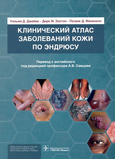 Книга: Клинический атлас заболеваний кожи по Эндрюсу (Джеймс Уильям Д., Элстон Дирк М., Макмэхон Патрик Д.) ; ГЭОТАР-Медиа, 2021 