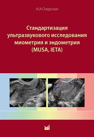 Книга: Стандартизация ультразвукового исследования миометрия и эндометрия (MUSA, IETA) (Озерская И.А.) ; Медпресс-информ, 2023 