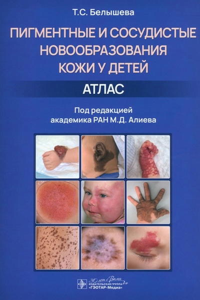 Книга: Пигментные и сосудистые новообразования кожи у детей. Атлас (Белышева Татьяна Сергеевна) ; ГЭОТАР-Медиа, 2023 