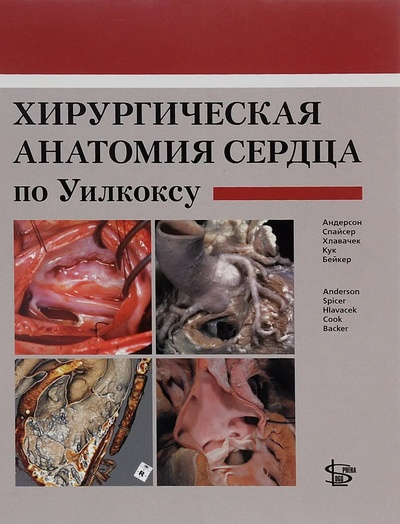 Книга: Книга Хирургическая анатомия сердца по Уилкоксу (коллектив авторов) 