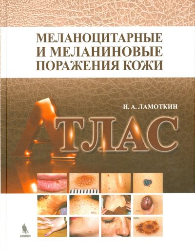 Книга: Меланоцитарные и меланиновые поражения кожи. Учебное пособие (Ламоткин Игорь Анатольевич) ; Бином, 2014 