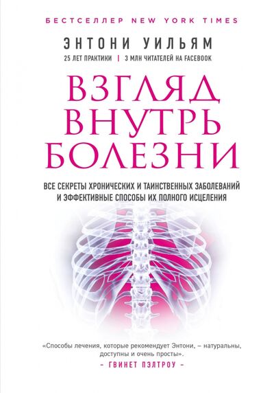 Книга: Взгляд внутрь болезни. Все секреты хронических и таинственных заболеваний (Уильям Энтони) ; Эксмо, 2019 