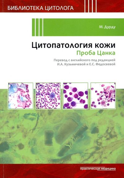 Книга: Цитопатология кожи. Проба Цанка (Дурду М.) ; Практическая медицина, 2021 