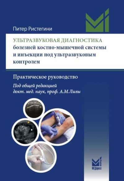Книга: Книга Ультразвуковая диагностика болезней костно-мышечной системы и инъекции под ультра... (Ристегини П) , 2023 