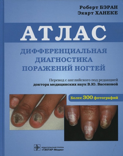 Книга: Книга Дифференциальная диагностика поражений ногтей (Бэран Роберт, Ханеке Экарт) ; ГЭОТАР-Медиа, 2022 
