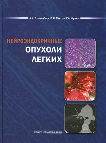 Книга: Книга Нейроэндокринные Опухоли легких (Трахтенберг Александр Хунович) , 2012 