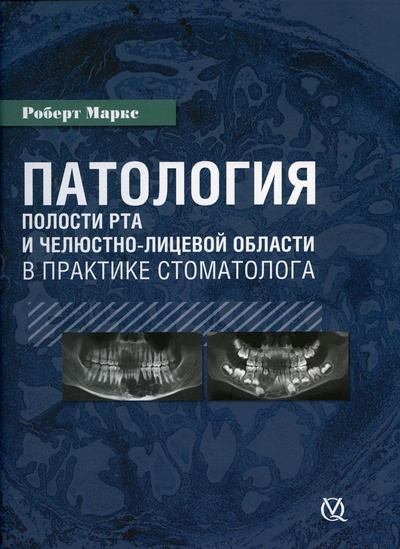 Книга: Книга Патология полости рта и челюстно-лицевой области в практике стоматолога (Маркс Роберт) ; Дентал-Азбука, 2019 
