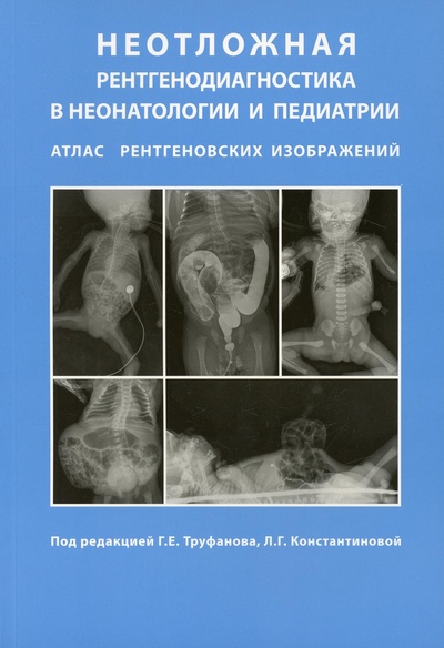 Книга: Книга Неотложная рентгенодиагностика в неонатологии и педиатрии (Труфанов Геннадий Евгеньевич) , 2020 