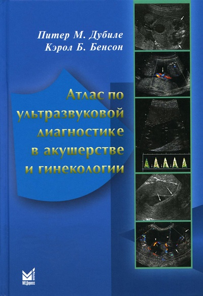 Книга: Книга Атлас по ультразвуковой диагностике в акушерстве и гинекологии. 4-е изд (Дубиле П.М.; Бенсон К.Б.) ; МЕДпресс-информ, 2022 
