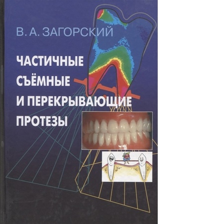 Книга: Книга Частичные съемные и перекрывающие протезы / Загорский (Загорский Валерий Арсентьевич) ; Медицина (Ханой, Вьетнам), 2007 