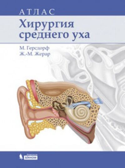 Книга: Хирургия среднего уха. Атлас (Герсдорф Мишель, Жерар Жан-Марк) ; Просвещение/Бином, 2014 
