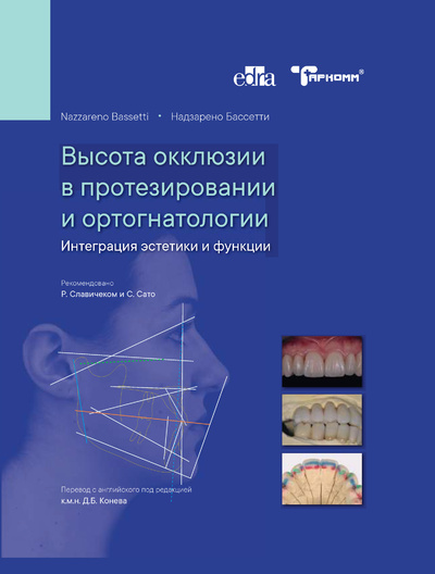Книга: Книга Высота окклюзии в протезировании и ортогнатологии - Надзарено Бассетти (Бессетти Надзарено) ; Таркомм, 2021 