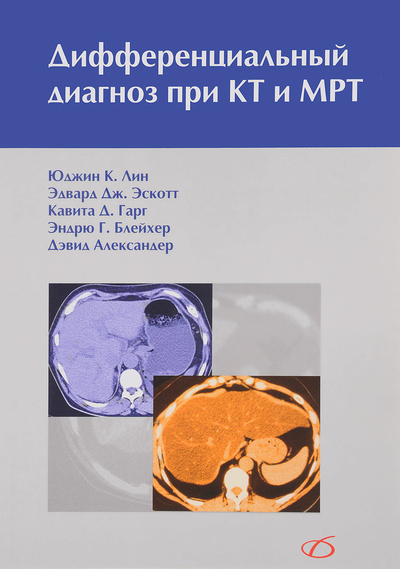 Книга: Дифференциальный диагноз при КТ и МРТ (Лин Ю. С, Эскотт Э. Дж, Гарг К. Д) ; Медицинская литература, 2017 