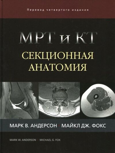 Книга: МРТ и КТ. Секционная анатомия (Андерсон Марк В., Фокс Майкл Дж.) ; Издательство Панфилова, 2018 