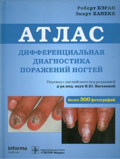 Книга: Дифференциальная диагностика поражений ногтей. Атлас (Бэран Роберт, Ханеке Экарт) ; ГЭОТАР-Медиа, 2022 