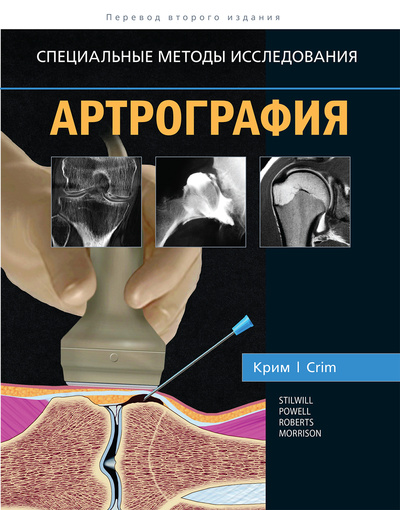Книга: Артрография (Крим, Р. Дж.) ; Издательство Панфилова, 2020 