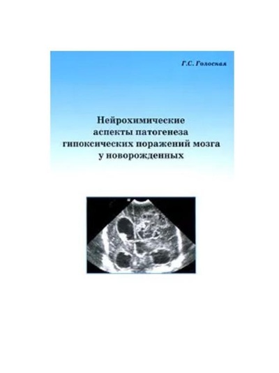 Книга: Нейрохимические аспекты патогенеза гипоксических поражений мозга у новорожденных (Голосная Г. С.) ; Медпрактика-М, 2020 