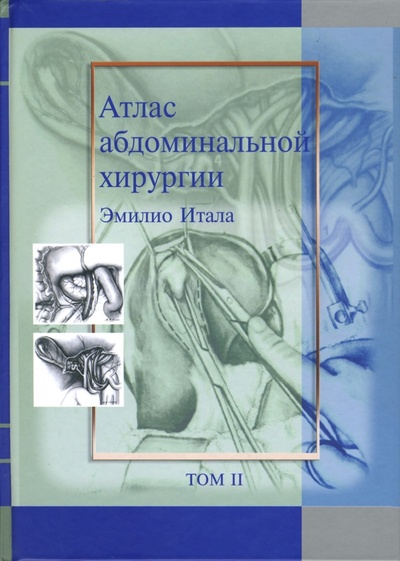 Книга: Атлас абдоминальной хирургии: Том 2. Хирургия желудка и двенадцатиперстной кишки (Итала Эмилио) ; Медицинская литература, 2009 
