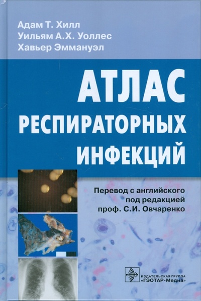 Книга: Атлас респираторных инфекций (Хилл Адам Т., Уоллес Уильям А. Х., Эммануэл Хавьер) ; ГЭОТАР-Медиа, 2011 