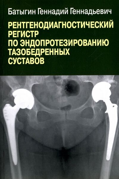 Книга: Рентгенологический регистр по эндопротезированию тазобедренных суставов (Батыгин Геннадий Геннадьевич) ; Высшее образование и наука, 2021 