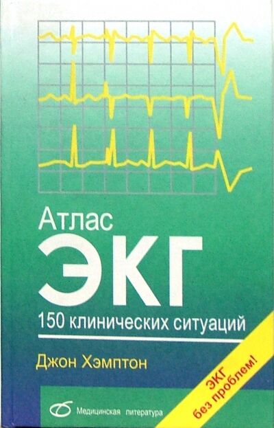 Книга: Атлас ЭКГ. 150 клинических ситуаций (Хэмптон Джон) ; Медицинская литература, 2008 