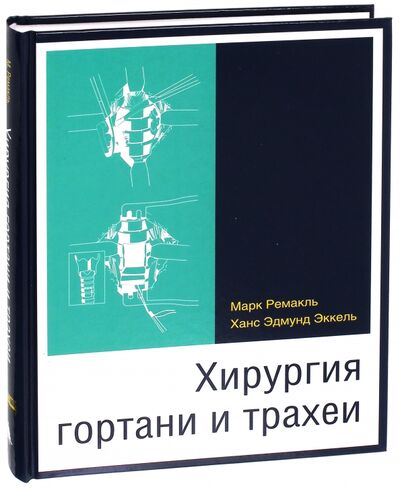Книга: Хирургия гортани и трахеи (Ремакль Марк, Эккель Ханс Эдмунд) ; Издательство Панфилова, 2014 