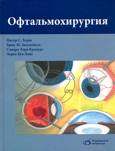 Книга: Офтальмохирургия (Херш Питер С., Загельбаум Брюс М., Кремерс Сандра Лора) ; Медицинская литература, 2020 