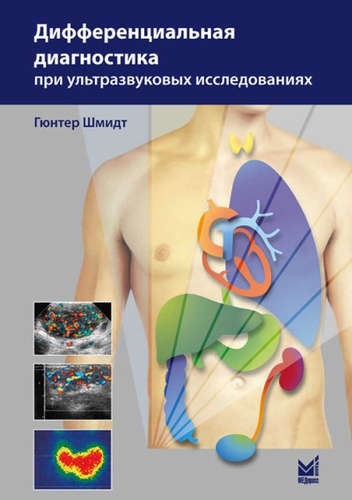 Книга: Дифференциальная диагностика при ультразвуковых исследования (Шмидт Вера) ; МЕДпресс-информ, 2014 