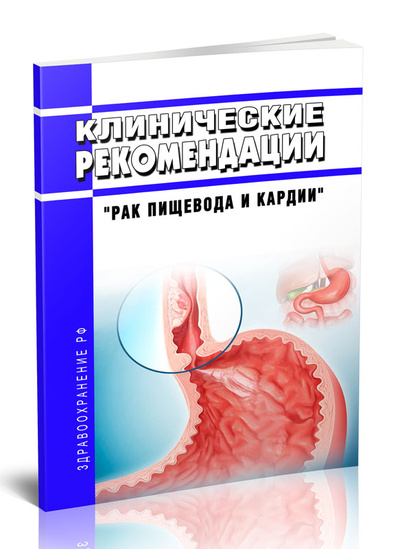 Книга: Клинические рекомендации Рак пищевода и кардии Взрослые (Без автора) , 2024 