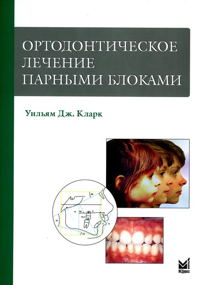Книга: Ортодонтическое лечение парными блоками (Уильям Кларк) , 2022 