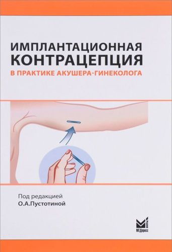 Книга: Имплантационная контрацепция в практике акушера-гинеколога (Пустотина О.А.) ; МЕДпресс-информ, 2017 