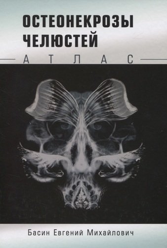 Книга: Остеонекрозы челюстей. Атлас (Басин Евгений Михайлович) ; Перо, 2020 