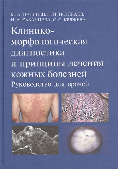Книга: Клинико-морфологическая диагностика и принципы лечения кожных болезней Руководство для врачей