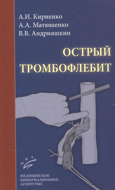 Книга: Острый тромбофлебит (Кириенко Александр Иванович) ; МИА, 2021 