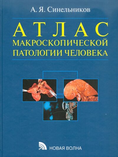 Книга: Атлас макроскопической патологии человека (Синельников Александр Яковлевич) ; Новая волна, 2007 