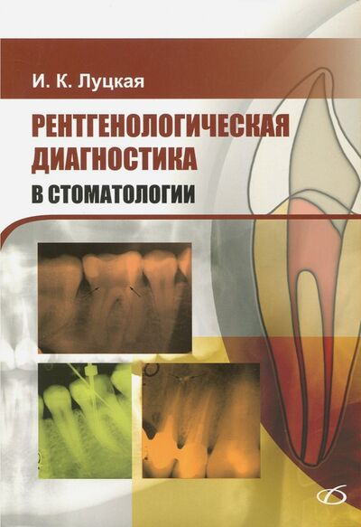 Книга: Рентгенологическая диагностика в стоматологии (Луцкая Ирина Константиновна) ; Медицинская литература, 2018 